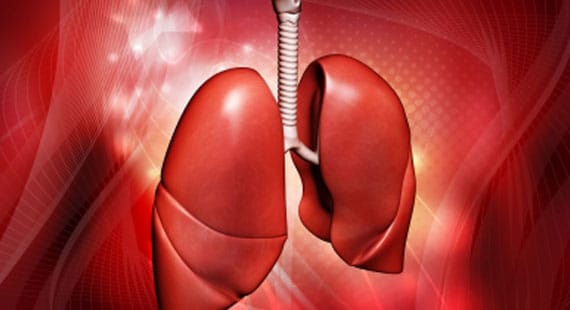 Symptoms of Lung Cancer and How Yoga Cure It