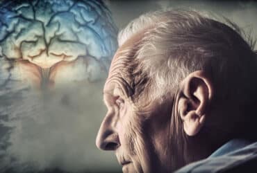 Common questions about alzheimer’s disease